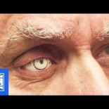 Así se hace un ojo protésico de modo artesano