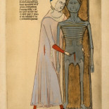 'El arte del cadáver' de Guido da Vigevano (1345) [eng]