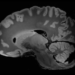 Resonancia magnética capturó la imagen más detallada del cerebro humano (ING)