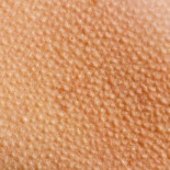 Descubren cómo se forman las glándulas sebáceas