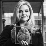 Joseph Lister ha salvado más vidas que ninguna otra persona en el mundo