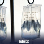 Un análisis de sangre detecta el cáncer de pulmón 4 años antes