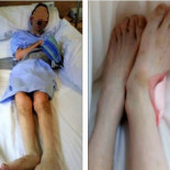 Hemipléjico, desnutrido y atado a la cama de una residencia |