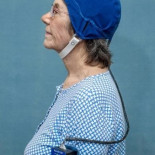 Un dispositivo en investigación logra revertir el deterioro cognitivo en pacientes con Alzheimer