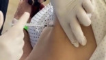 Graba cómo vacunan contra el coronavirus a su abuela con una jeringuilla vacía