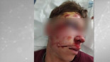 Ingresado un menor tras recibir una brutal paliza de unos desconocidos