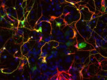 Transforman por primera vez astrocitos en neuronas para reparar circuitos visuales