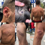 Joven detenido en Vallecas denuncia que dos guardias civiles le han dado "una paliza" en los juzgados