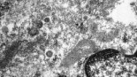 El Hospital de Mar de Barcelona fotografía el coronavirus en los vasos sanguíneos