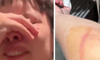 Denuncia un ataque homofóbico en Tarazona: «es vergonzoso que esto siga pasando»