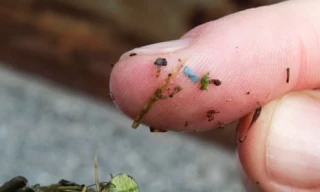 Los microplásticos se están infiltrando en el tejido cerebral, según muestran los estudios: "No queda ningún lugar intacto" (ENG)