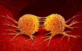 Los científicos descubren células que impulsan el crecimiento agresivo de tumores (eng)