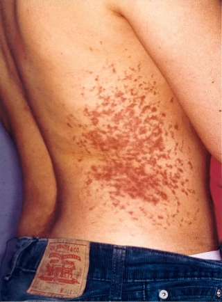 El TC rechaza el recurso de Sorzabal a la condena de 24 años que ignoró su denuncia de torturas