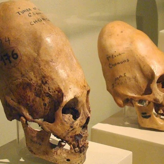 La deformación craneal en las culturas antiguas