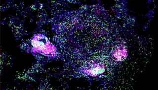 La vacuna candidata contra la tuberculosis ofrece protección completa (eng)