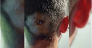 "Mi casero me pegó un tiro en la cabeza porque le debía dos meses de alquiler"