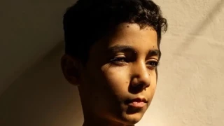 Una fotografía sobre las secuelas de la guerra en niños gazatíes gana el World Press Photo global 2025