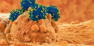 CAR-T: así funciona la terapia que está revolucionando la lucha contra el cáncer