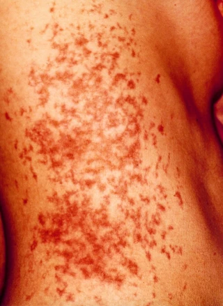 La Audiencia Nacional absuelve a Iratxe Sorzabal y reconoce «tratos inhumanos»