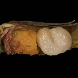 La falta de alimento acelera la metamorfosis en las abejas