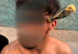 Clavan un destornillador en la cabeza a un hombre durante una violenta pelea en Albatera