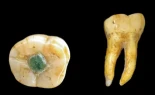 Encuentran el primer empaste dental conocido realizado con piedras preciosas en una muela por los mayas