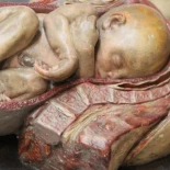 Enseñar la medicina a través del arte: la escultura anatómica en la universidad española