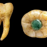 El engaste de jade en un molar plantea nuevas preguntas sobre la práctica odontológica maya [Eng]