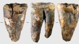 Un diente de 59.000 años de antigüedad ofrece una visión excepcional de cómo los neandertales abordaban un problema médico