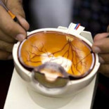 Terapia genética permite que mujer que era ciega ahora pueda incluso leer [ENG]