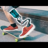 Probando una nueva pierna protésica