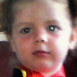 Salvan la vida a una niña de 2 años al diagnosticarle un cáncer viendo su foto en Facebook [Eng]