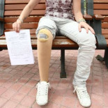 Los policías me agredieron y me dijeron: "No te hagas la coja"