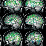 Así reacciona el cerebro de una mujer cuando alcanza un orgasmo