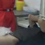 Mete su pene en el anillo de bodas y termina en Urgencias (ENG)