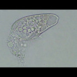 Organismo unicelular muriendo