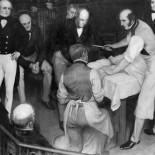 “El cuchillo más rápido de Londres”: cuando la cirugía era una carrera de velocidad contra la muerte