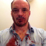 El editor de la revista de temática gay "Polari" y su pareja reciben una paliza en Londres [ENG]