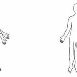 Cuando al paciente le crece un brazo imaginario