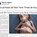 Ha muerto Amal, la niña que se convirtió en un símbolo de la destrucción de Yemen