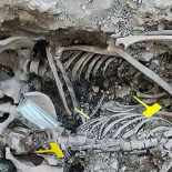 Exhuman los cuerpos de 17 personas asesinadas en 1936 en Pomer (Zaragoza)