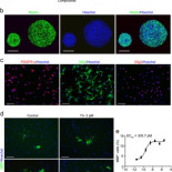 Un medicamento para el alzheimer promueve la formación de mielina en el cerebro [EN]