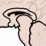 No era ELA sino Neuromielitis optica