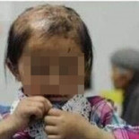 Niña china sometida a terribles abusos encontrada vagando por la calle con la boca cosida