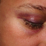 15 hombres dan una paliza brutal a un grupo de ocho lesbianas