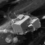 Científicos españoles logran generar ‘huesos artificiales’ a partir de células madre procedentes de cordón umbilical