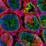 Gracias a CRISPR, un nuevo modelo podría acelerar la investigación del Cáncer de Colon (ENG)