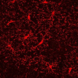 Antiinflamatorios para mejorar los problemas cognitivos por la abstinencia de la nicotina