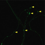 Científicos logran capturar la primera imagen de la génesis de un recuerdo
