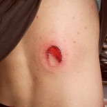 Fotos del desalojo de Kukutza en Rekalde